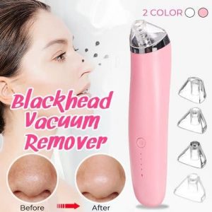 Electric Facial Pore & Acne Remover discountshub