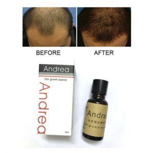Andrea Andrea Hair Growth Oil discuntxhub