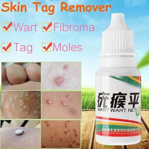 Skin Tag Mole & Genital Wart Remover Foot Corn Removal 10ml discountshub