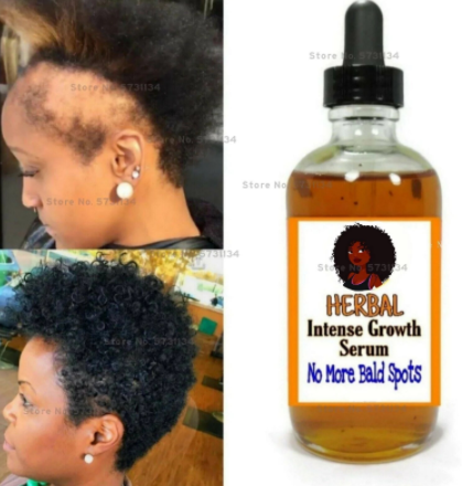 Black Seed Castor Oil Hair Growth Serum, Thick Hair, Fast Growth 20ml Free Shipping discountshub